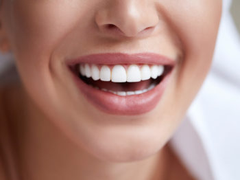 lente de contato dental e facetas