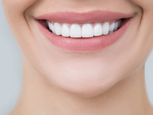 lente de contato dental e facetas